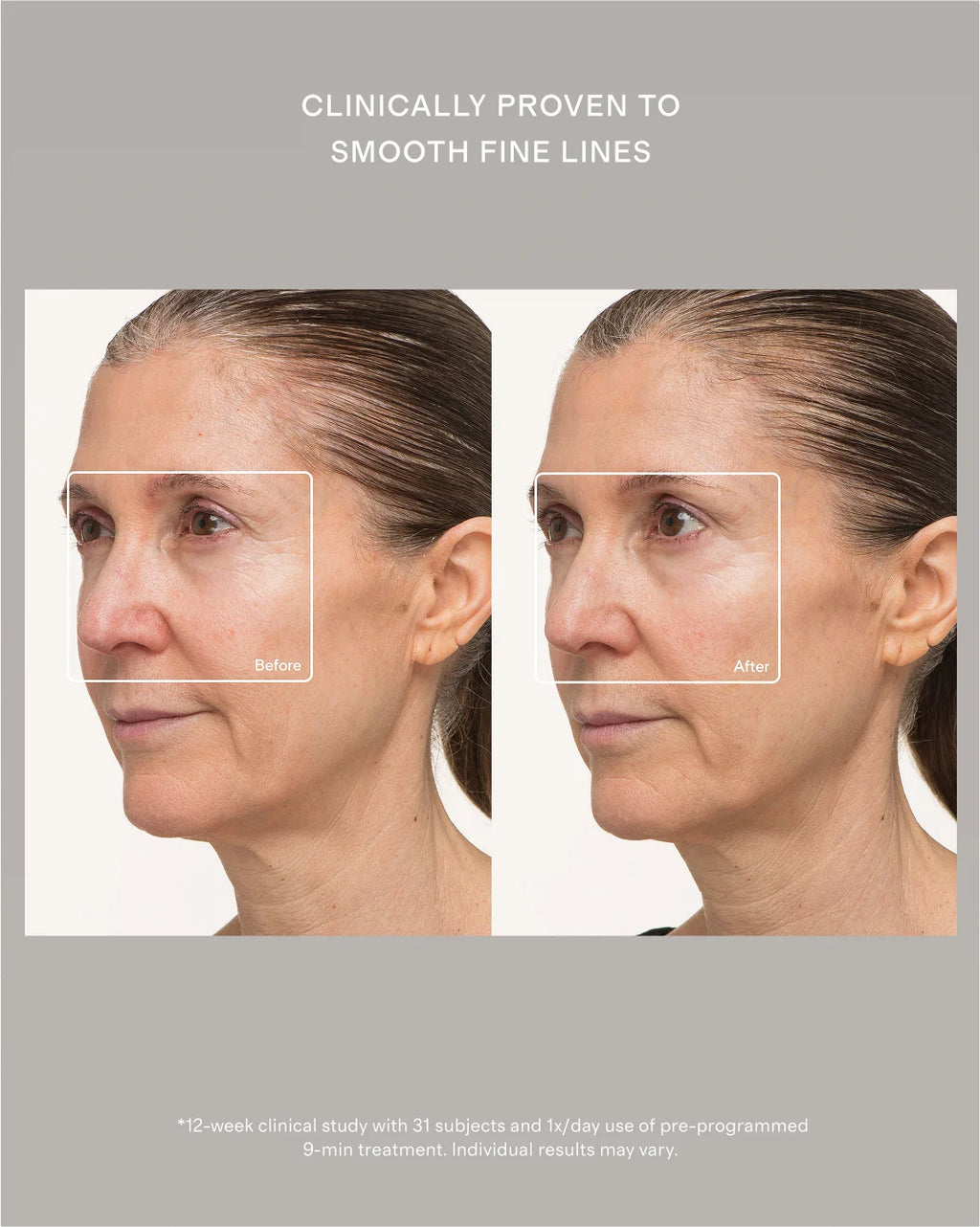 TheraFace Mask by Therabody - One Size / No Color